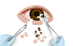 Evolution of refractive surgeries infographic