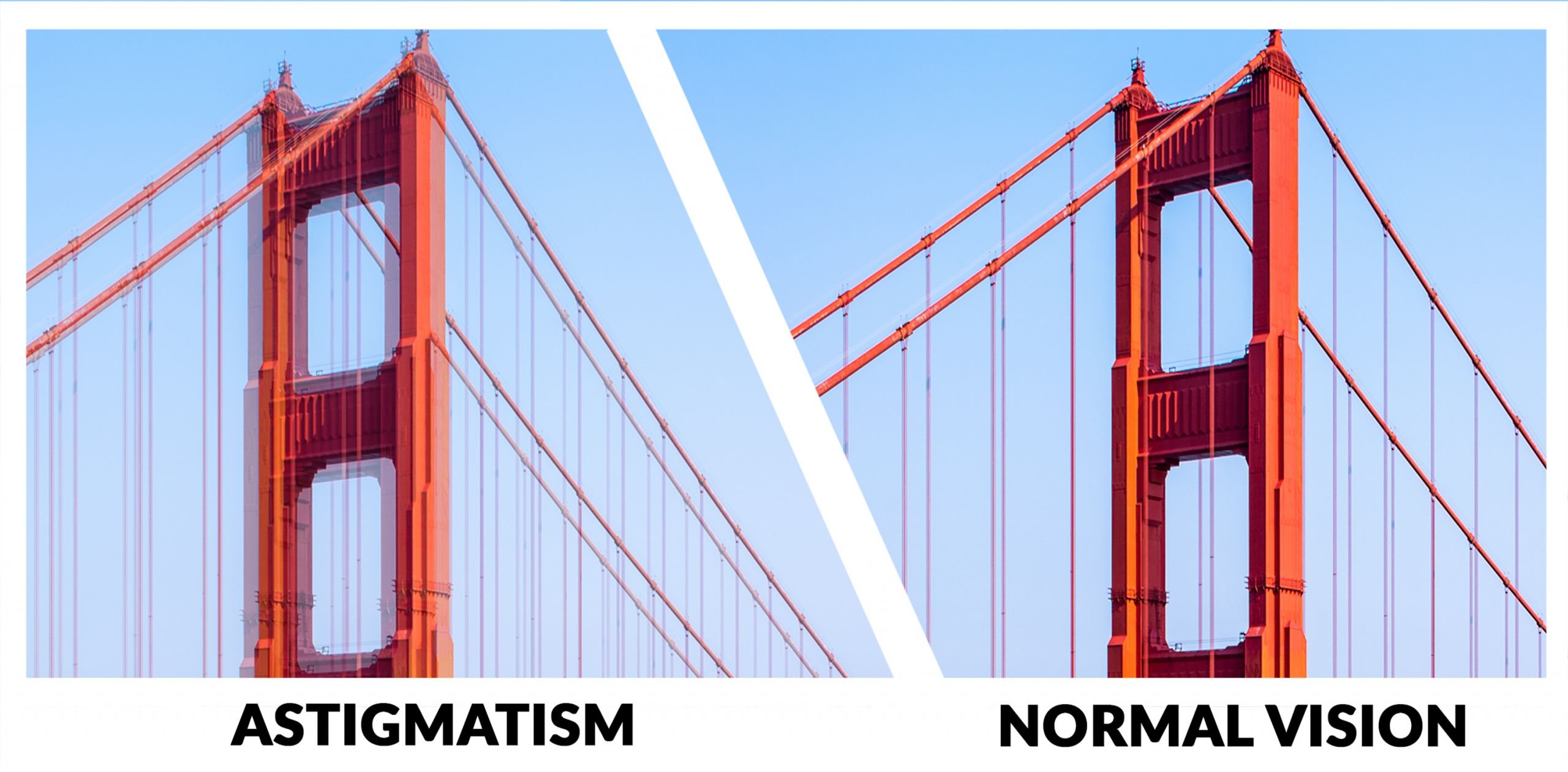 Symptoms of Astigmatism