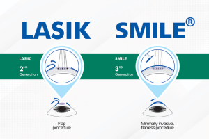 LASIK vs. SMILE comparison image discussing differences in vision correction techniques