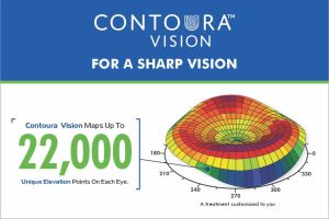 Advantages of Contoura Vision infographic outlining its benefits for vision correction