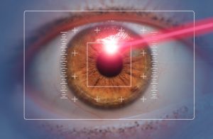 Benefits of LASIK laser surgery