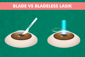 Blade vs. bladeless LASIK comparison image