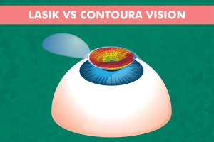 LASIK vs. Contoura Vision infographic comparing two advanced eye surgery options