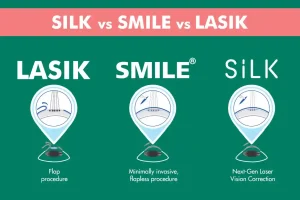 Comparing Advanced Vision Correction Techniques SILK vs. SMILE vs. LASIK