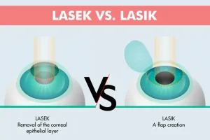 LASIK vs. LASiK Surgery