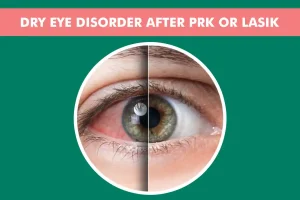 Preventing Dry Eye Disorder After PRK or LASIK Eye Surgery