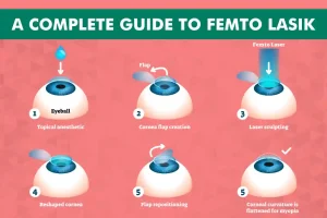 A Complete Guide to Femto LASIK: What to Expect Before, During, and After