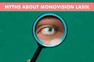 Debunking Common Myths About Monovision LASIK