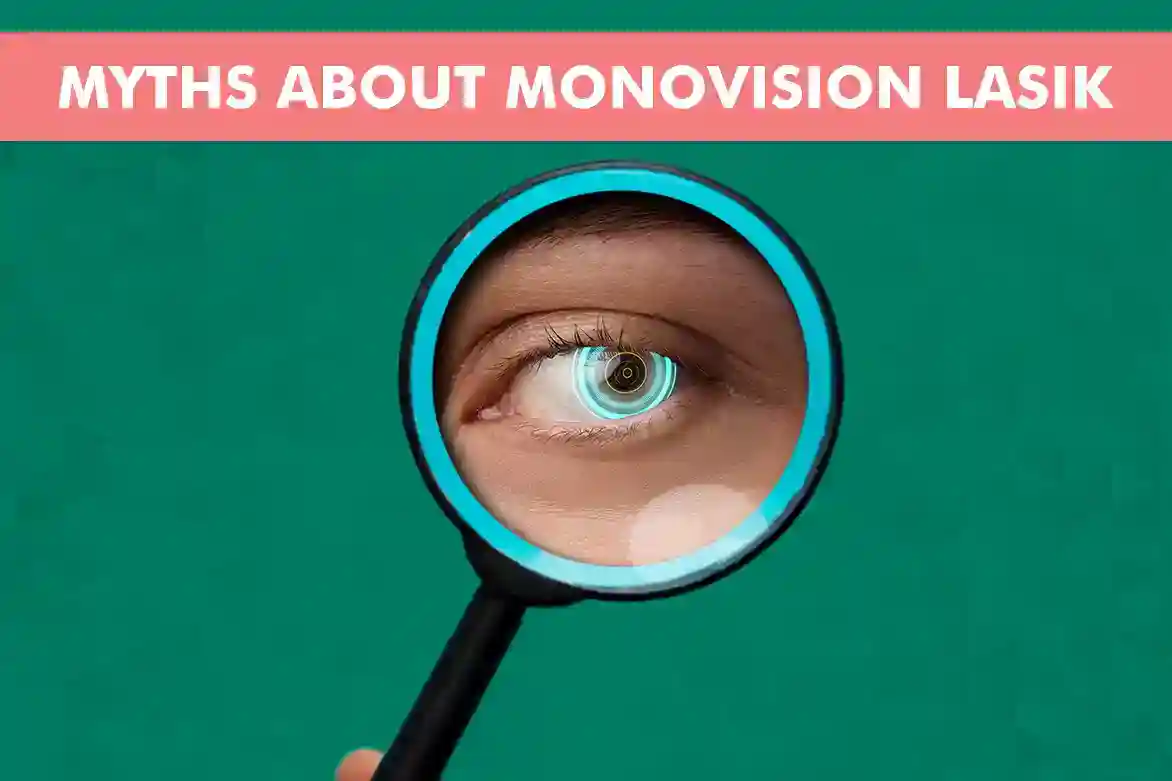 Debunking Common Myths About Monovision LASIK