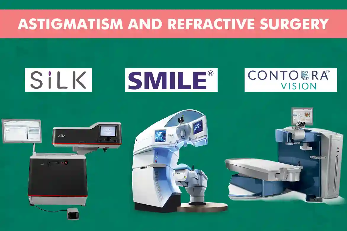 Astigmatism and Refractive Surgery What Are Your Options