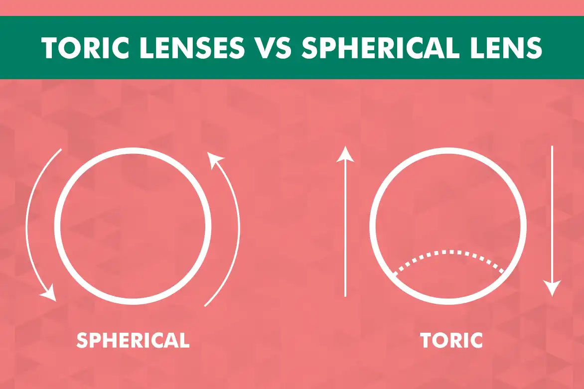 Toric Lenses vs Spherical Lens Understanding the Differences and Benefits