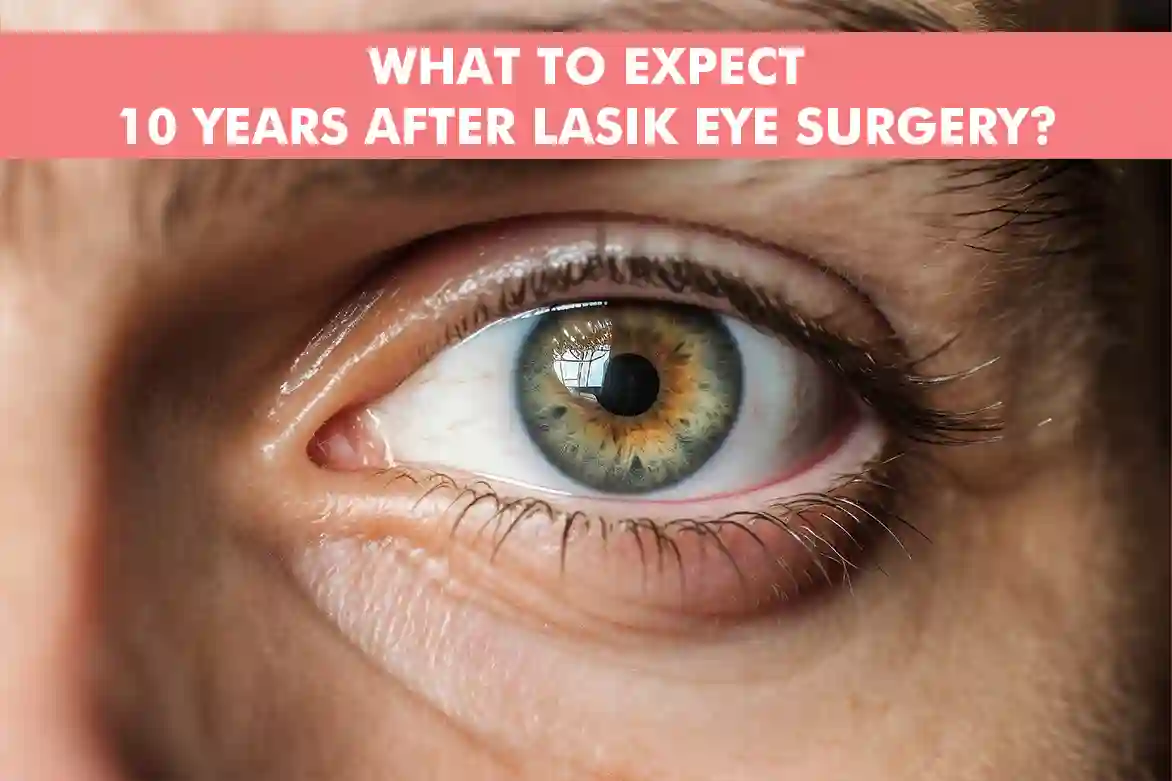 10 Years After LASIK Eye Surgery What to Expect