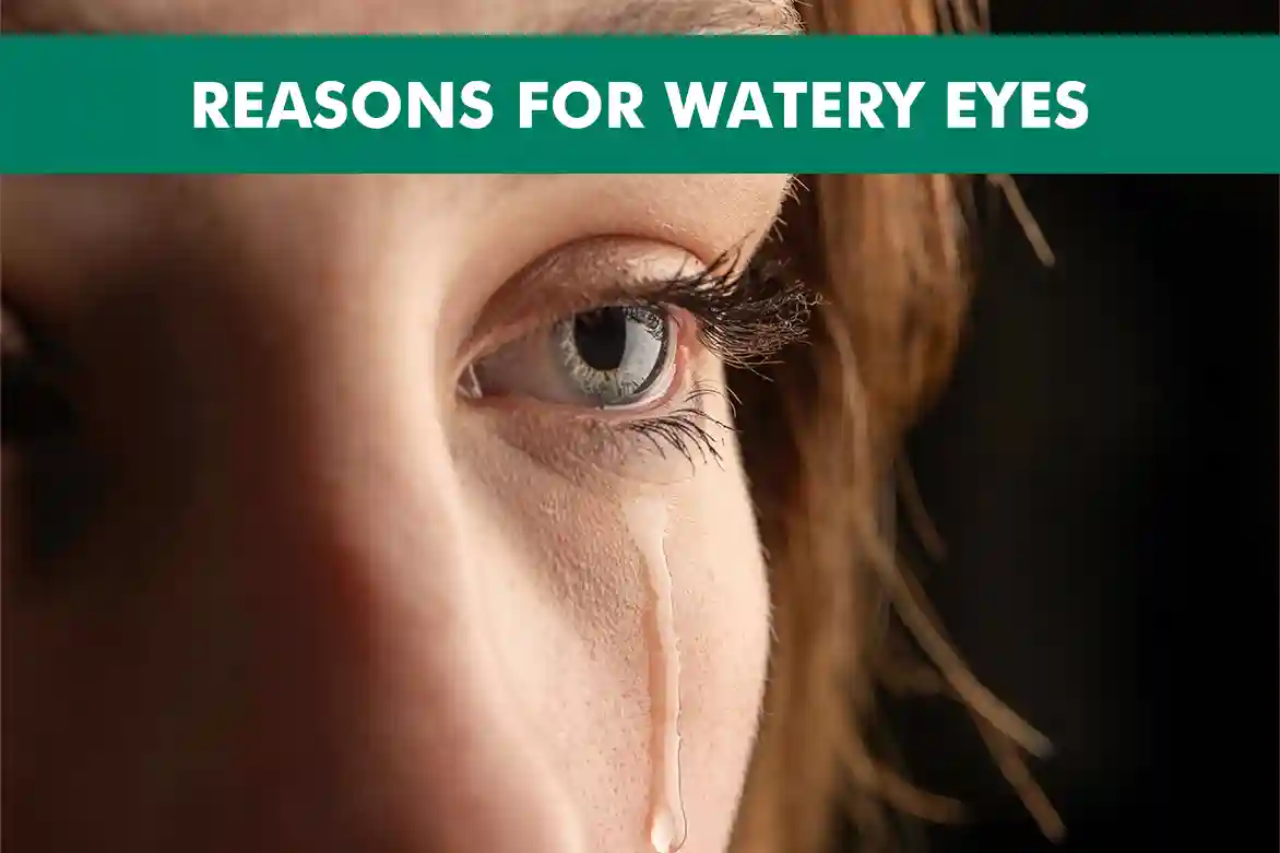 Reasons for Watery Eyes & How to Treat Them