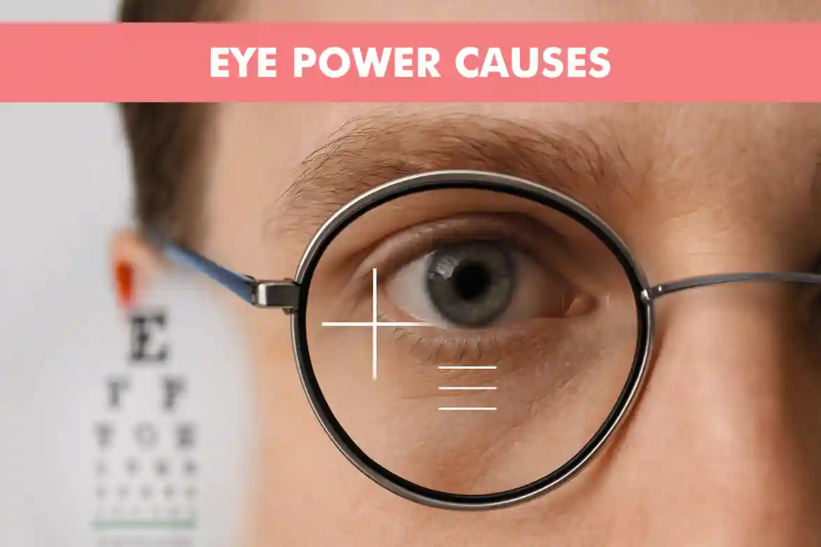Eye Power Causes: Why It Increases and How to Control It