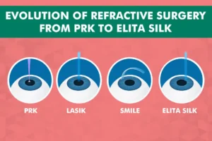 Evolution of Refractive Surgery From PRK to Elita SILK