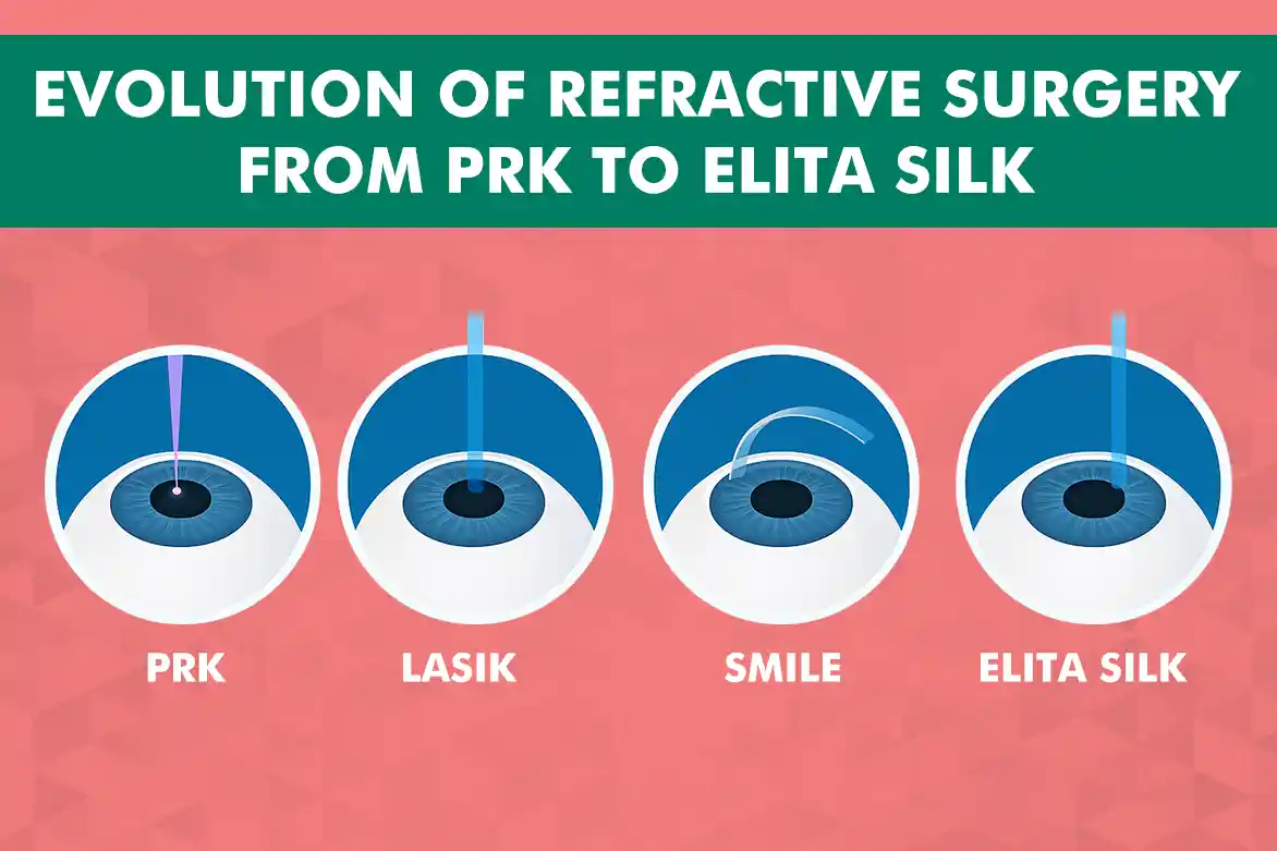 Evolution of Refractive Surgery From PRK to Elita SILK